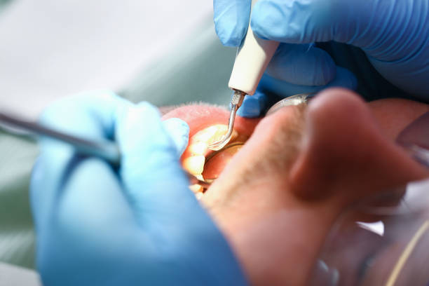 Best Emergency Cosmetic Dentistry (e.g., broken veneers) in Tashua, CT